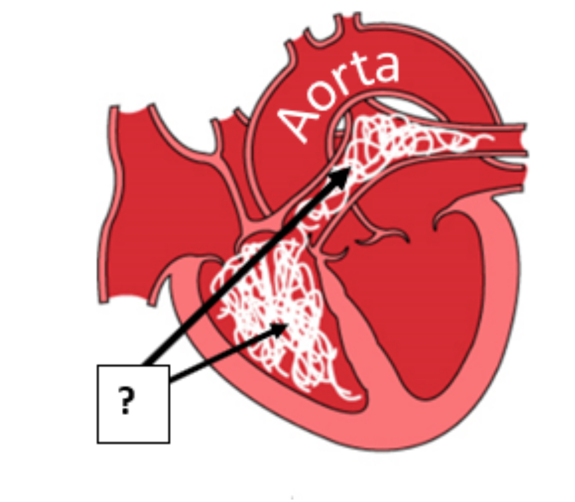 <p>This diagram illustrates what's happening in the abnormal radiograph. &nbsp;In dogs, adult heartworms take up residence in which chamber of the heart and which blood vessel (as indicated)?</p><p>Chamber: __________&nbsp; &nbsp; (Blank 1)</p><p>Blood vessel: ___________ (Blank 2)</p>