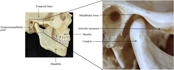 <p><strong>HOLLOW (Ditch-like) AREA IN A BONE</strong> that can <strong>FORM JOINTS </strong>or <strong>GIVE AREA OF ATTACHMENTS</strong></p><ul><li><p>It’s like a small dip in the bone</p></li><li><p>A spot where muscles can attach</p></li><li><p>Fossa = TRENCH/DITCH in Latin</p></li></ul><p></p>