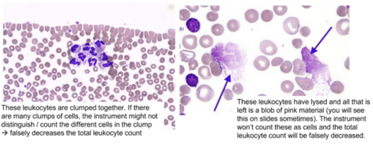 <p>clumped or fragile leukocytes; clumps may be counted as a single cell or fragile leukocytes that lyse would not be counted at all</p>