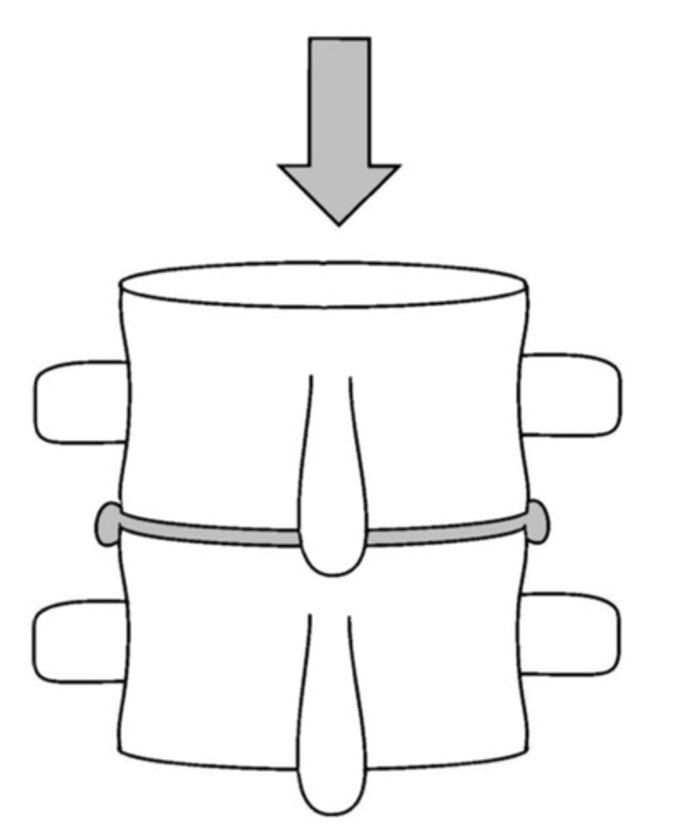 <p>+Y translation restriction (motion listing)</p>