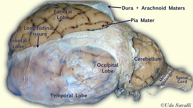 <p><strong>Dura Mater,</strong> arachnoid mater, pia mater </p>