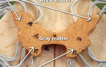 <p>bottom arrows </p>