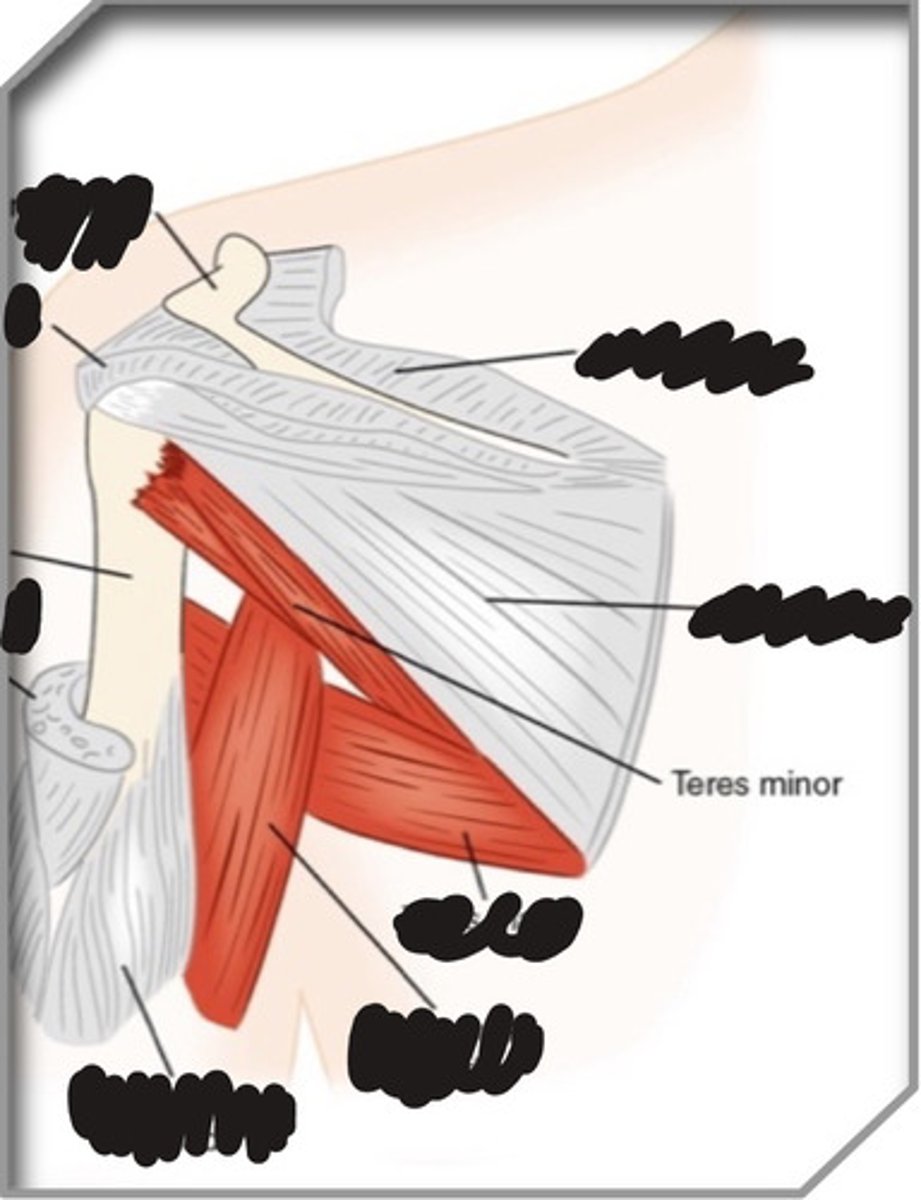<p>What muscle is this?</p>
