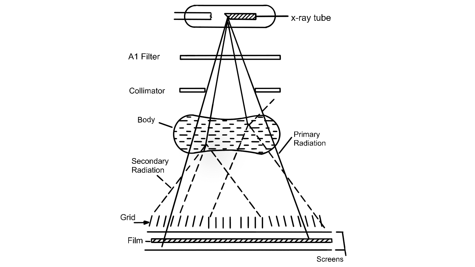 <p>What are <strong>X-ray machines? What do they do?</strong></p>