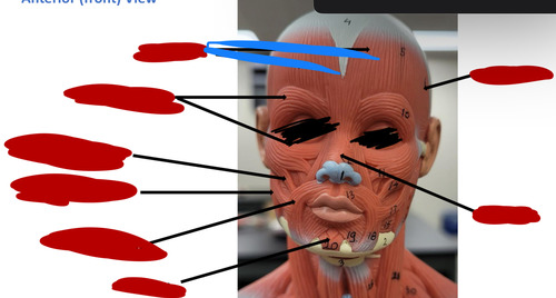 <p>What muscle is this?</p>