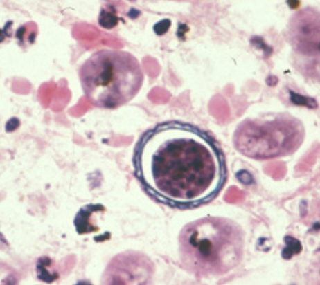 <p>in brain tissue; hall’s coccus</p>