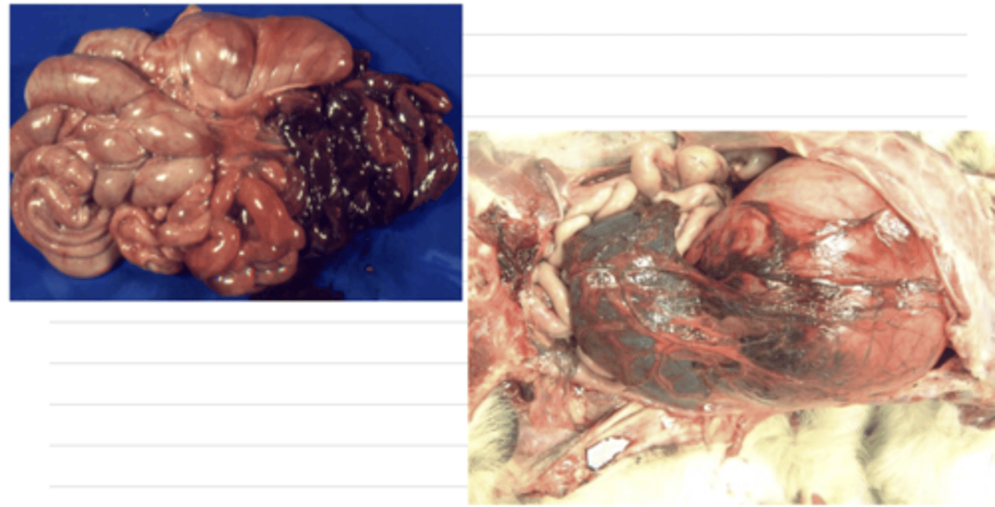 <p>dark red/purple</p><p>dilated vessels</p>