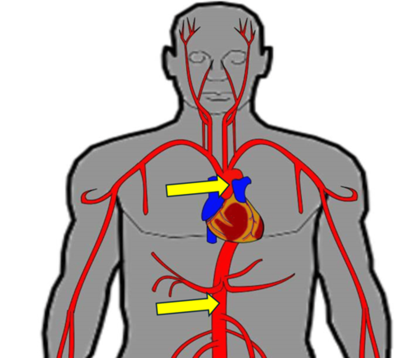 <p>Name the red vessel - general whole thing.</p>