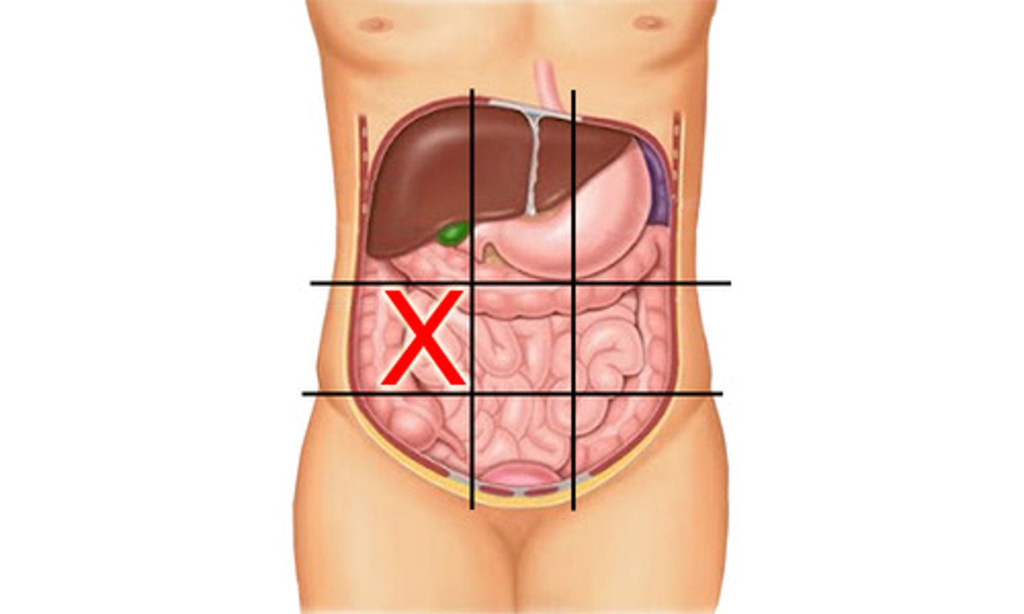 knowt flashcard image