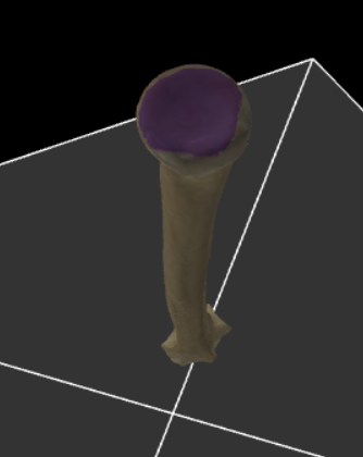 <p>Een schotelvormig uitgehold articulatievlak aan de bovenkant van de radius voor articulatie met het capitulum humeri.</p>