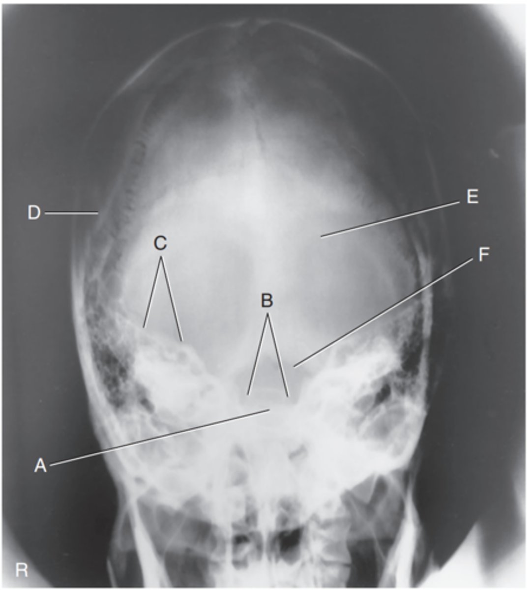<p>Label B</p>
