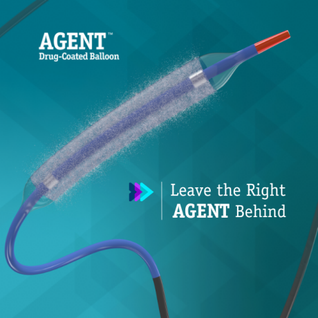 <p><strong>AGENT<span data-name="tm" data-type="emoji">™</span> Drug-Coated Balloon (DCB)</strong></p>