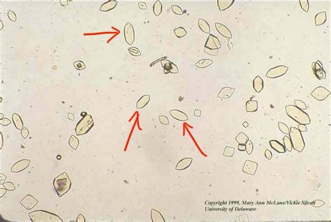 <p>What do you see in this image?</p><p>Is it clinically significant?</p><p>Acidic or Alkaline?</p><p>What can it indicate?</p>