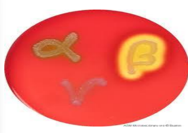 <p>explain the 3 types of haemolysis on blood agar  with examples !!!!</p>