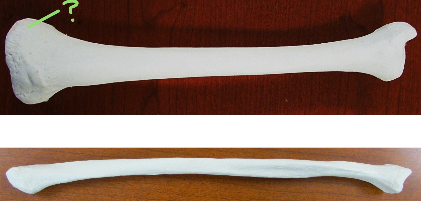 <p>Determine the part of the Tibia highlighted</p>
