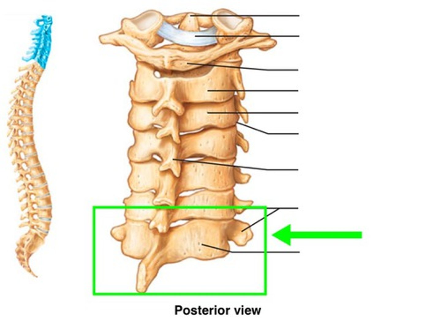<p>bow down head and feel most prominent bone on neck.</p><p>Unlike the other cervical vertebrae, this one has a large spinous process that protrudes posteriorly at back of neck.</p><p>last cervical vertebrae before thorax.</p><p>ligamentum nuchae (thick ligament on back of head) and muscles such as trapezius attach here.</p><p></p>