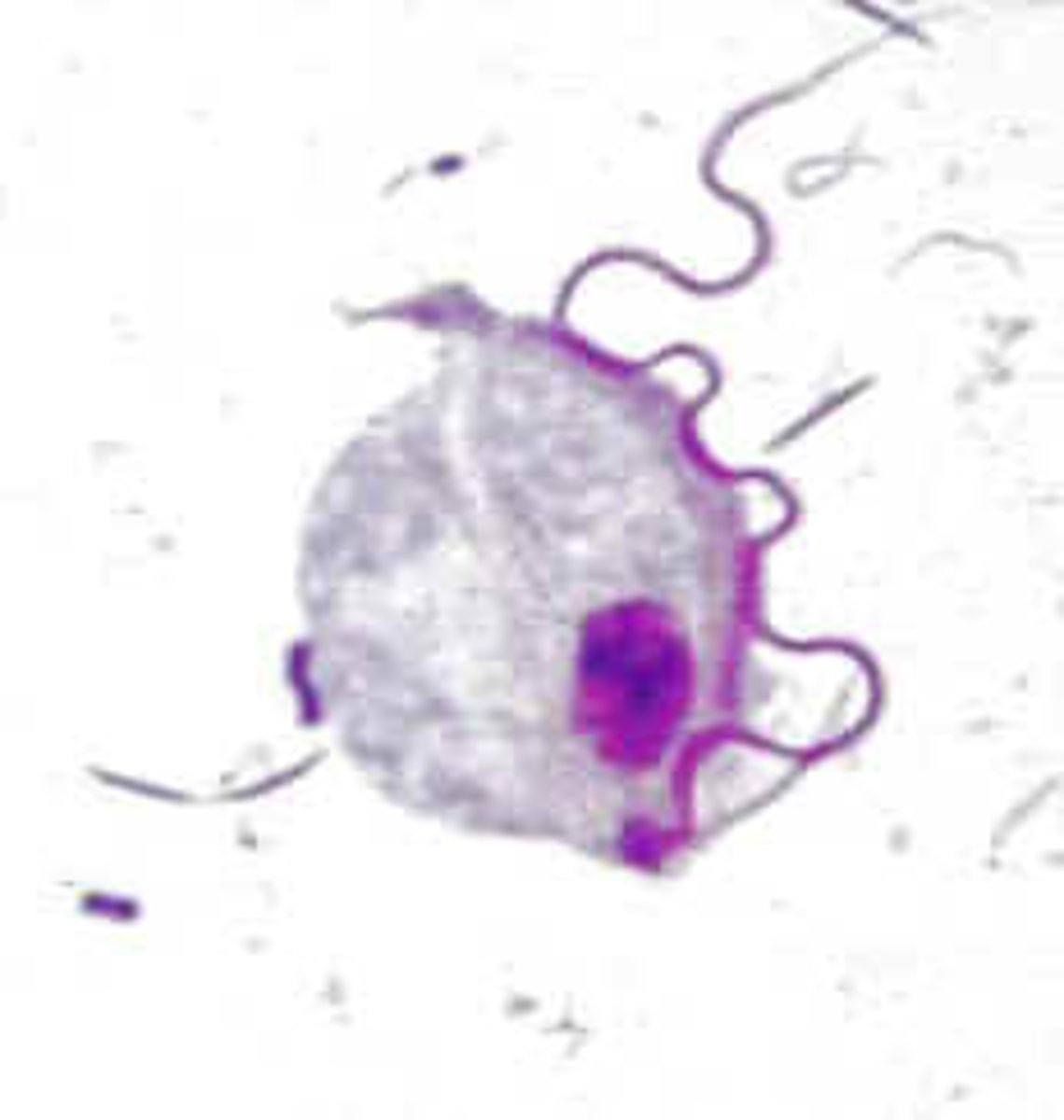 <p>mostly parasites, symbionts</p><p>tetrakont</p><p>recurrent flagellum</p><p>undulating membrane</p><p>costa (contracts)</p><p>axostyle</p><p>Hydrogenosome</p>