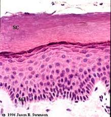 <p>The outermost layer of the epidermis, consisting of dead cells that provide a barrier to the environment.</p>
