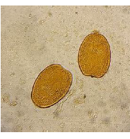 <p><strong>Identify the parasitic stage.</strong></p><p><strong>Mention the contents of this stage.</strong></p><p><strong>State the best method for diagnosing this disease?</strong></p>