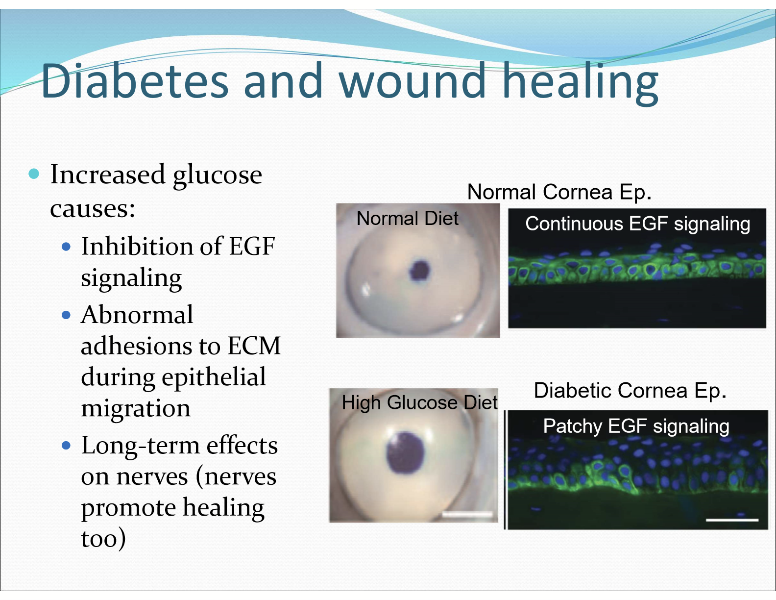 <p>Increase glucose causes inhibition of EFG signaling, causing abnormal adhesions to ECM during epithelial migration. Excess glucose also leads to excess sorbitol preventing healing of corneal epithelium. </p>