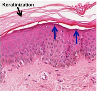 <p>Keratinized Stratified Squamous Epithelium — Description</p>