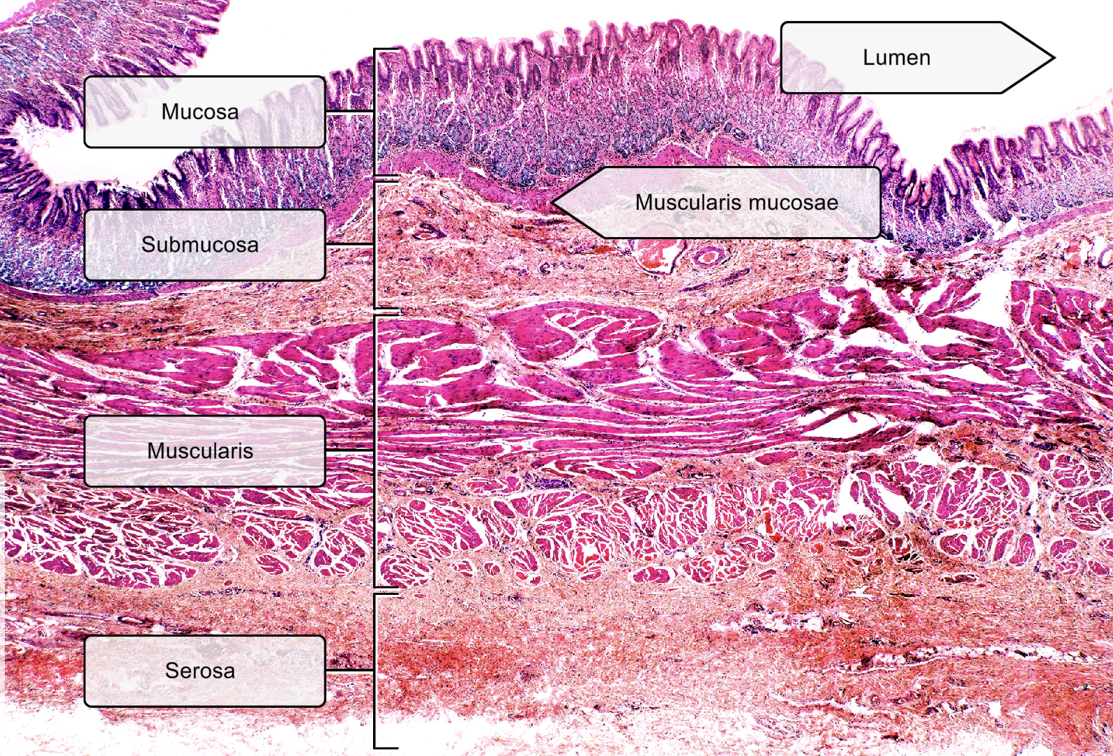 <p>Mucosa- <span><u>simple columnar epithelium &amp; mucous cells</u></span></p><p><u>(Contains Gastric pits and Gastric glands)</u></p>