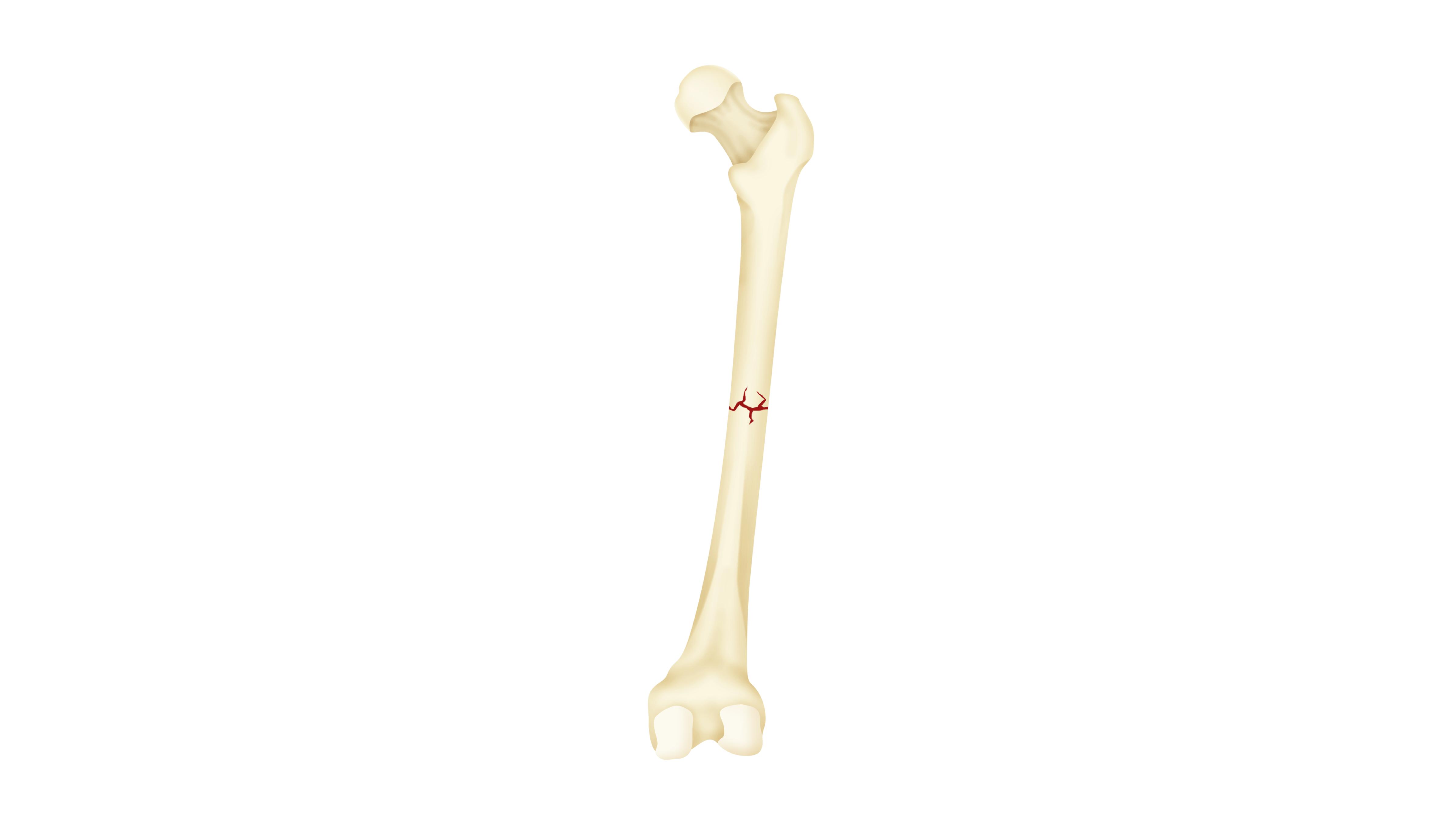 bone ends retain their normal position