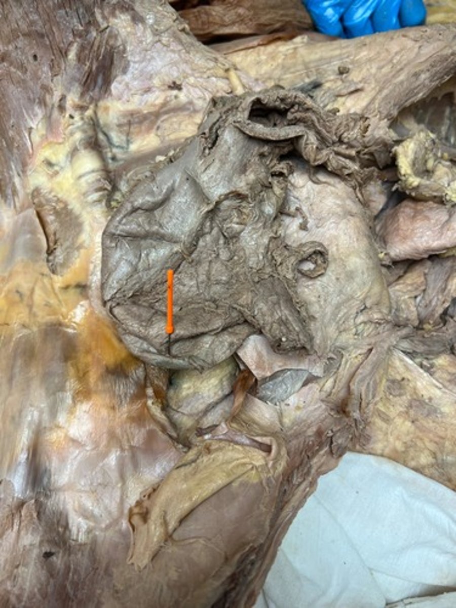 <p>fundus of stomach</p>