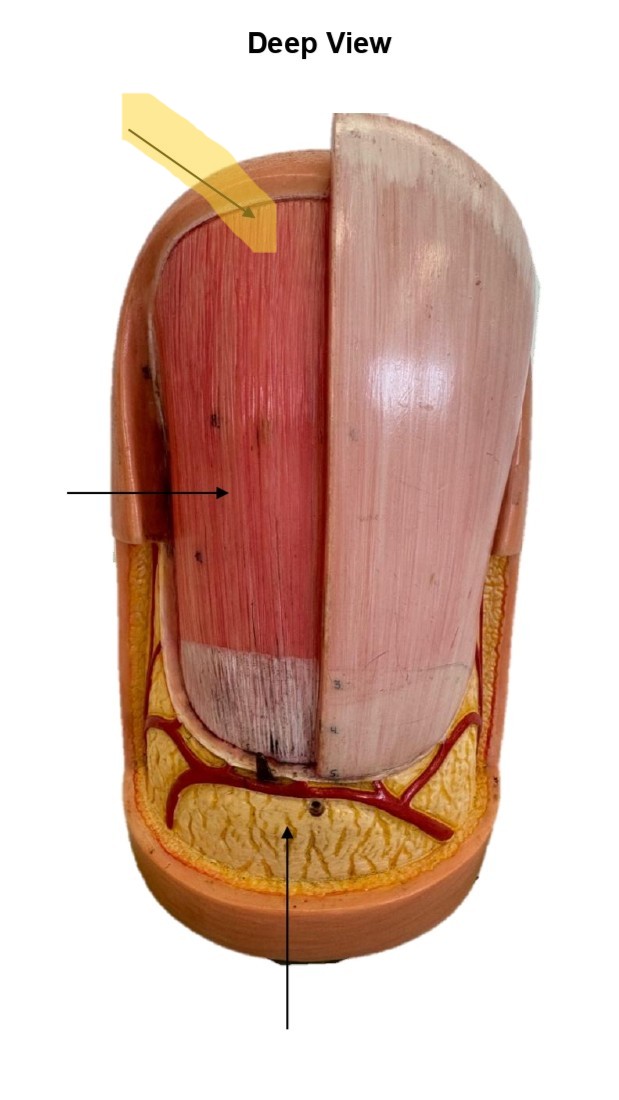 term image