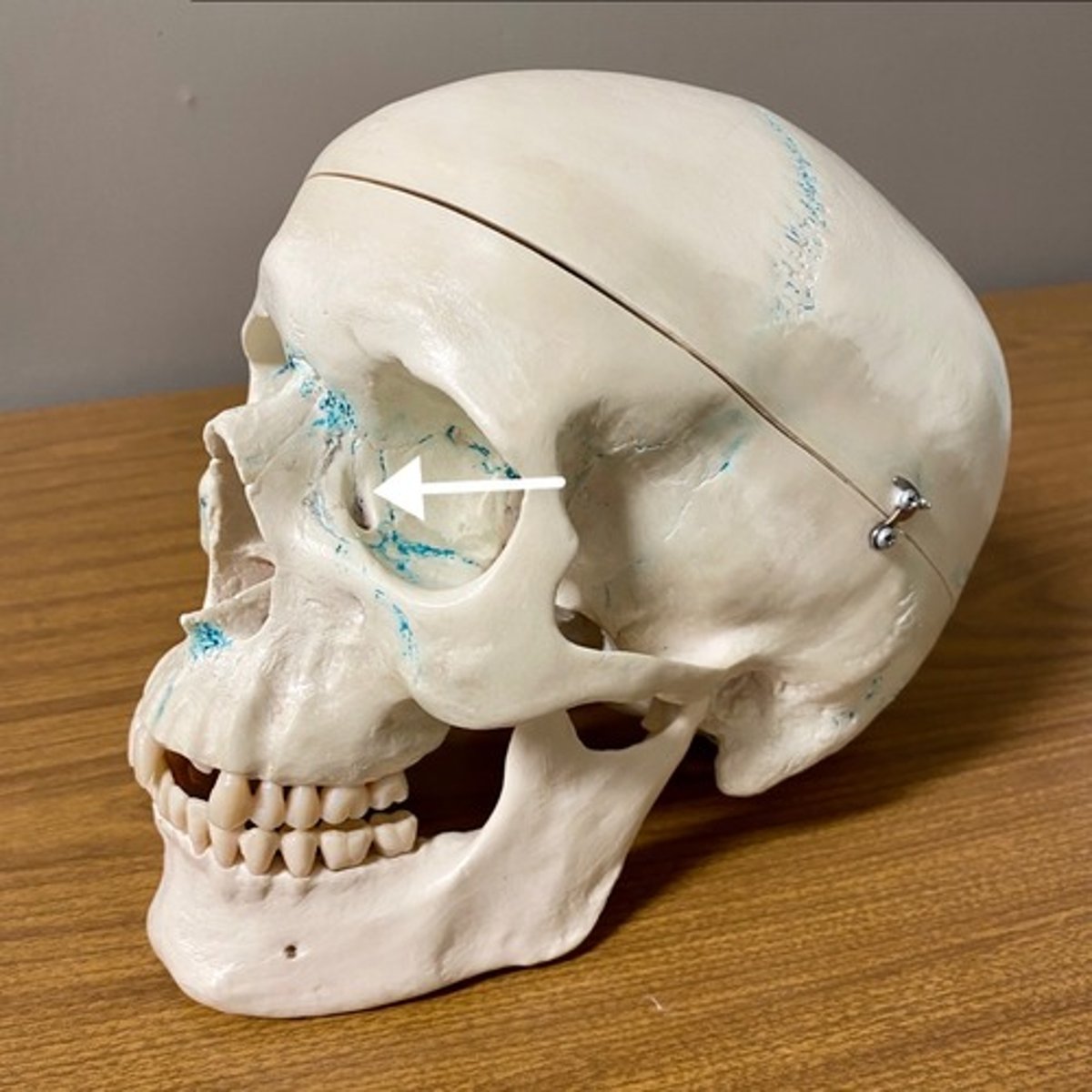 <p>What bone is this?</p>
