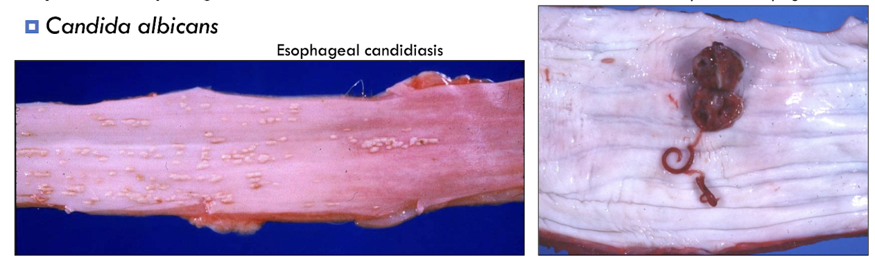 <ol><li><p><strong>parasites</strong> → <em>Spirocerca lupi</em> form cystic granuloma</p></li><li><p><strong>fungal</strong> → <em>Candida albicans</em> (thrush)</p></li></ol><p></p>