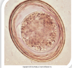 <p>both canine and feline small intestine can cause gastrointestinal obstruction vomiting diarrhea pot belly adults also present in vomitus</p>