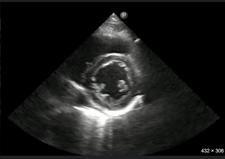 <p>Identify structures and the view of this echo</p>