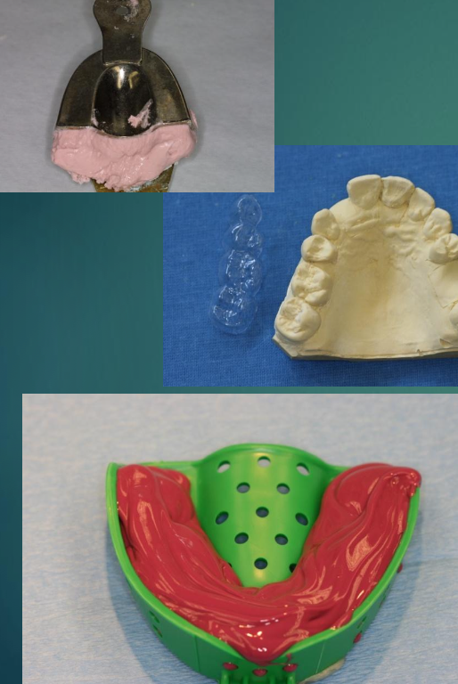 <p>What is the fourth step to fabricating a provisional implant restoration?</p>