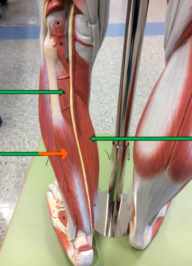 <p>Identify this muscle?</p>
