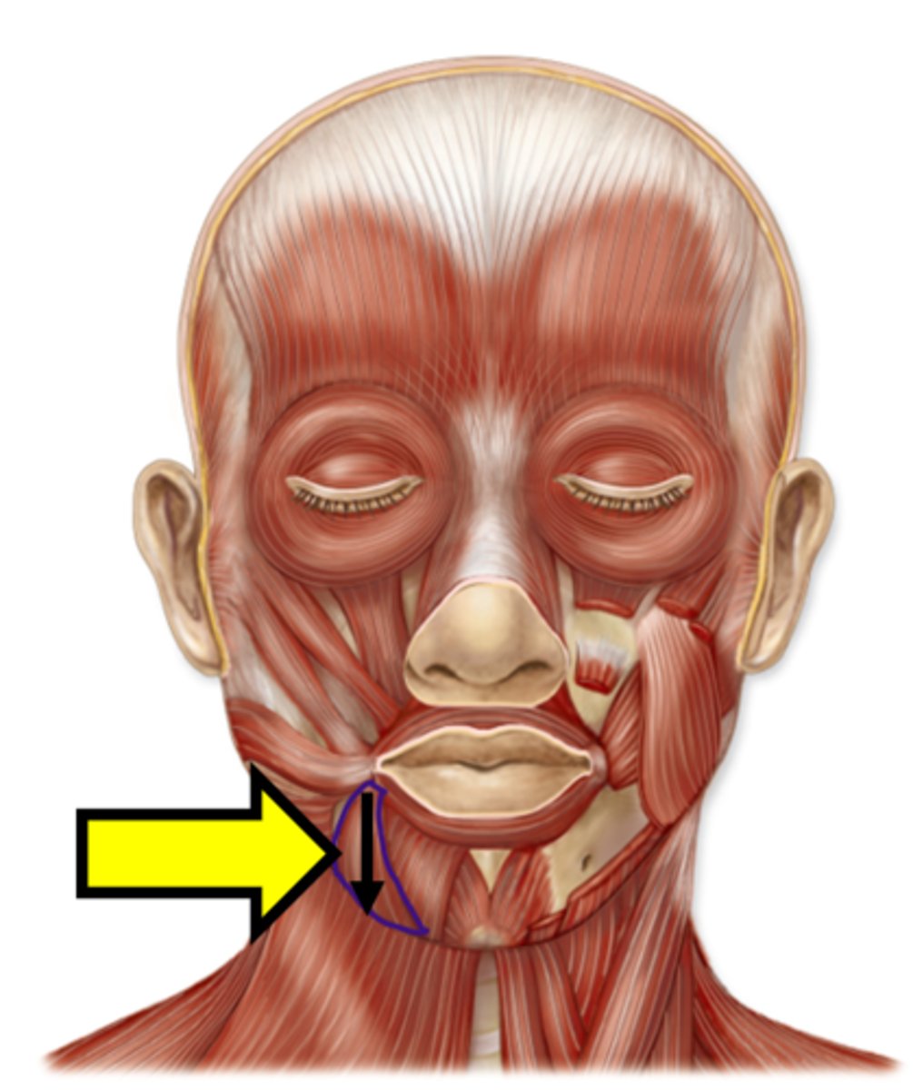 <p>Name the muscle.</p>