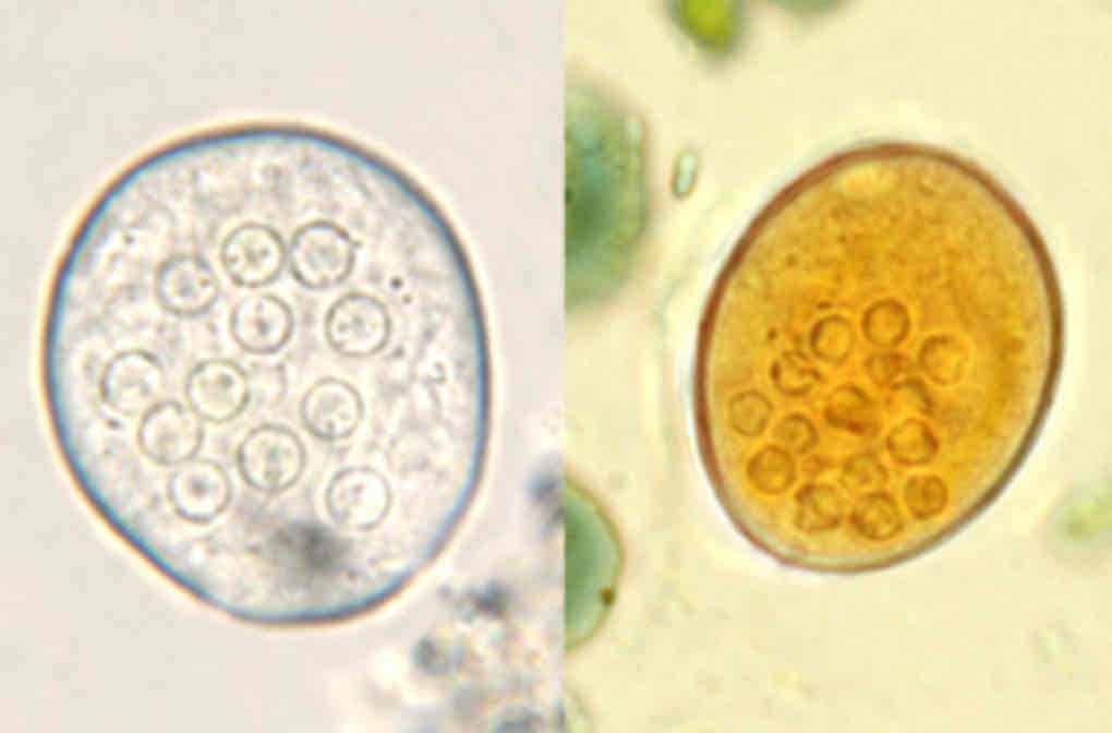 <p>Endosimbionte commensale dell’intestino dei mammiferi, anche nell’uomo.</p><p>Vive nel lume dell’intestino crasso e raramente si ciba delle cellule dell’ospite.</p><p>Cisti composte da più di 4 nuclei (fino a 32)</p>