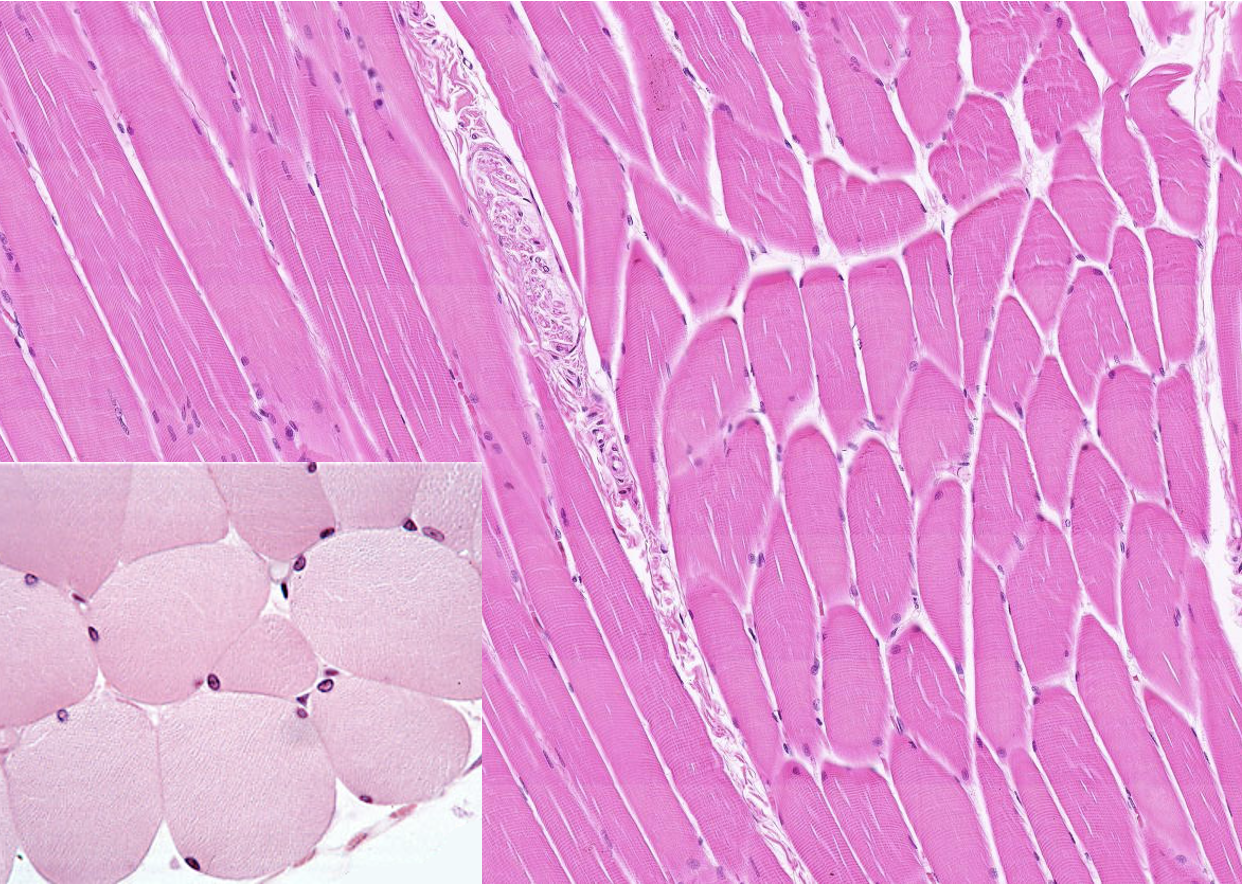 <p>What type of tissue is this? What are the cells in the bottom left corner?</p>