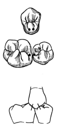 <p>one tooth to two tooth arrangement</p><p>commonly used for single restorations</p>