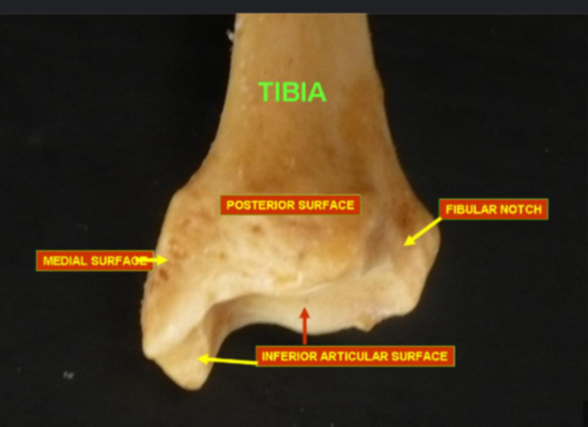 <p>the fibular notch of the tibia: </p>
