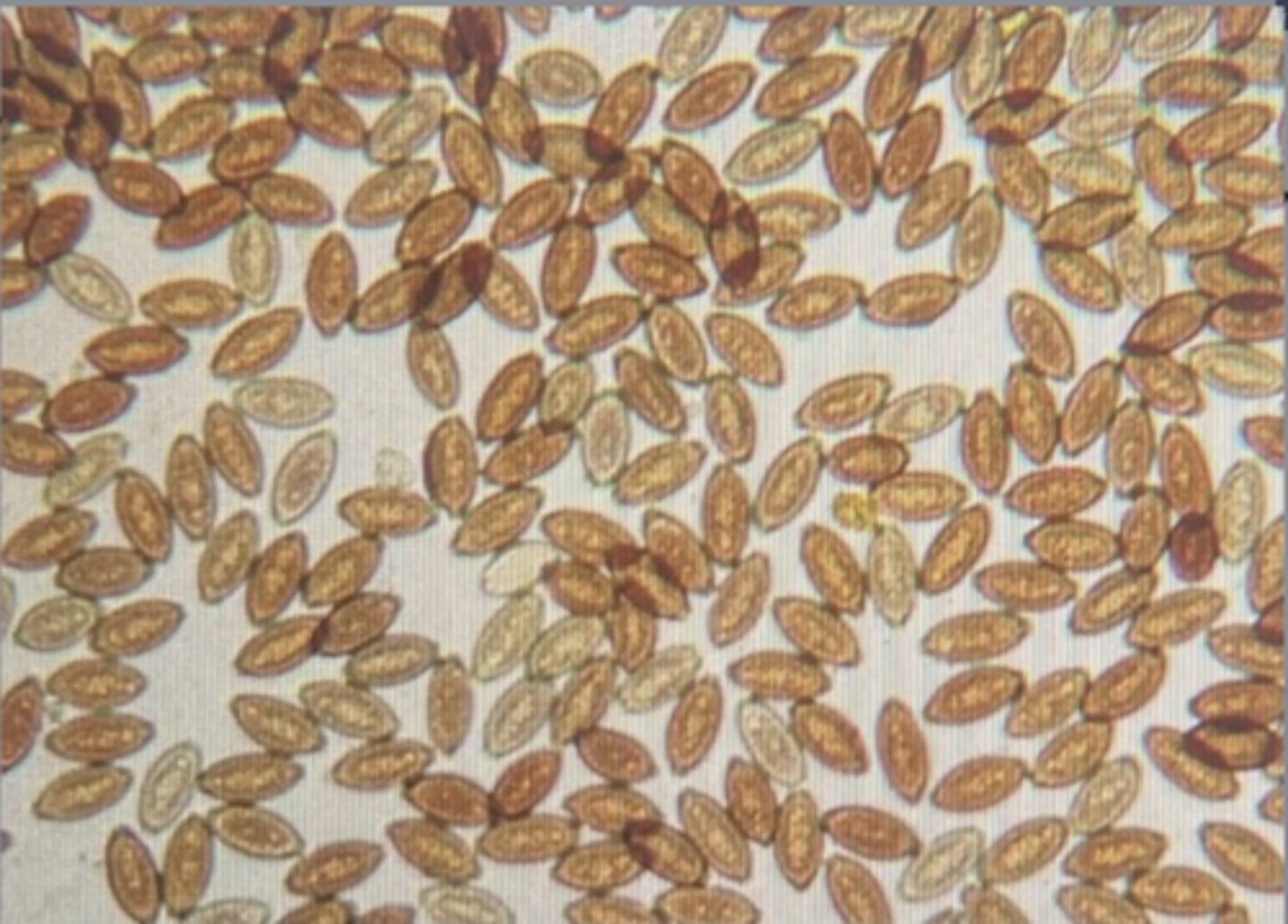 <p>Eggs that look like these were found on the fecal floatation of a 5-year-old mixed breed hound confined in a backyard run. They measure approximately 90x40um. What is the most appropriate therapeutic intervention?</p>