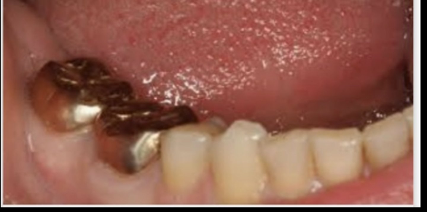 <p>What crown is this?</p>