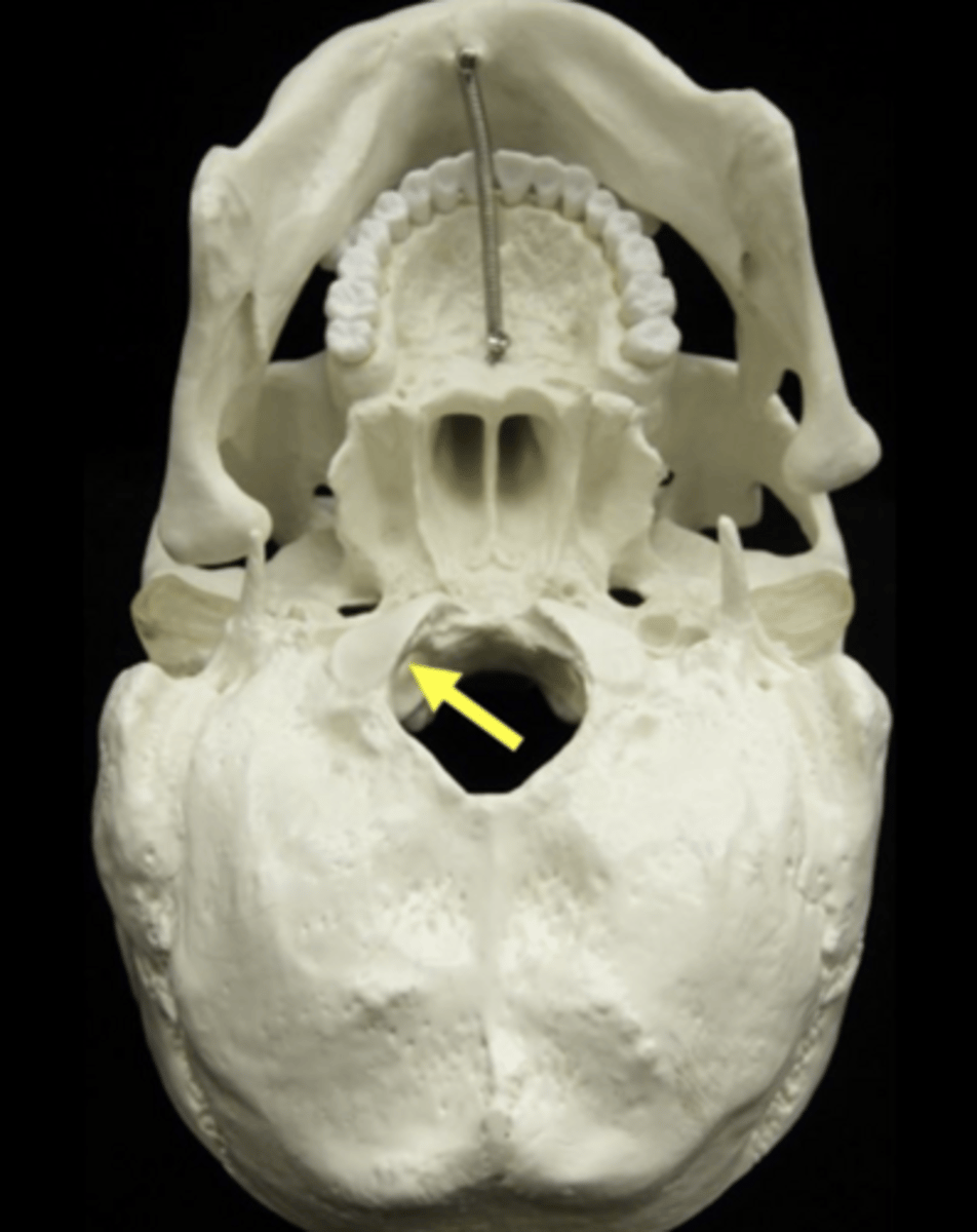 <p>Name the bone and feature</p>