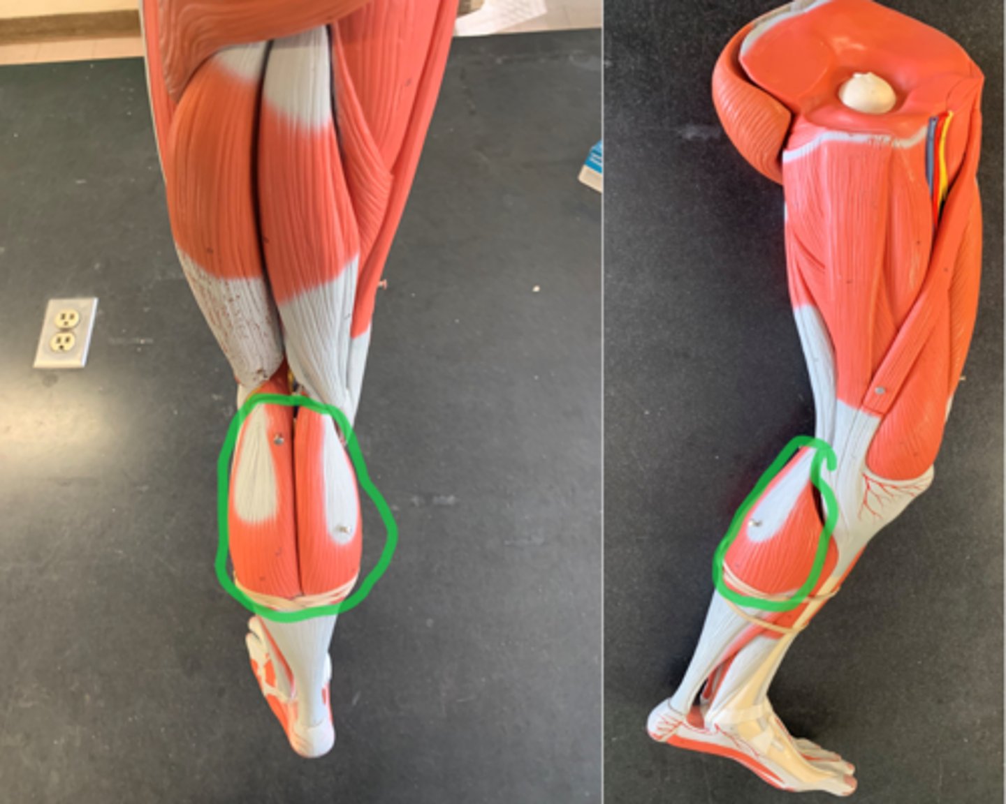 <p>Gastrocnemius, medial head:</p><p>Origin: Medial Condyle of Femur</p><p>Insertion: Calcaneus</p><p>Gastrocnemius, lateral head</p><p>Origin: Lateral Condyle of Femur</p><p>Insertion: Calcaneus</p>