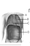 <p>Pericardial</p>