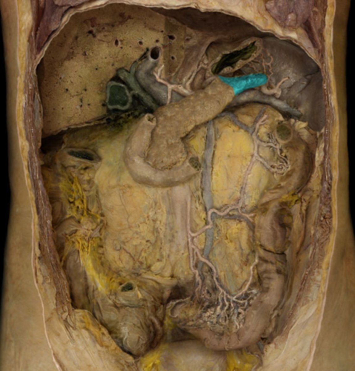 <p>What part of the pancreas is this?</p>