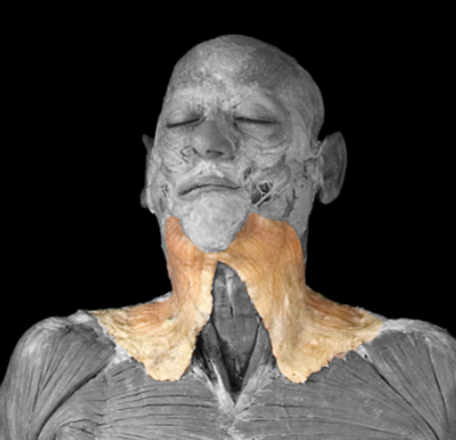 <p>What muscle is this?</p>