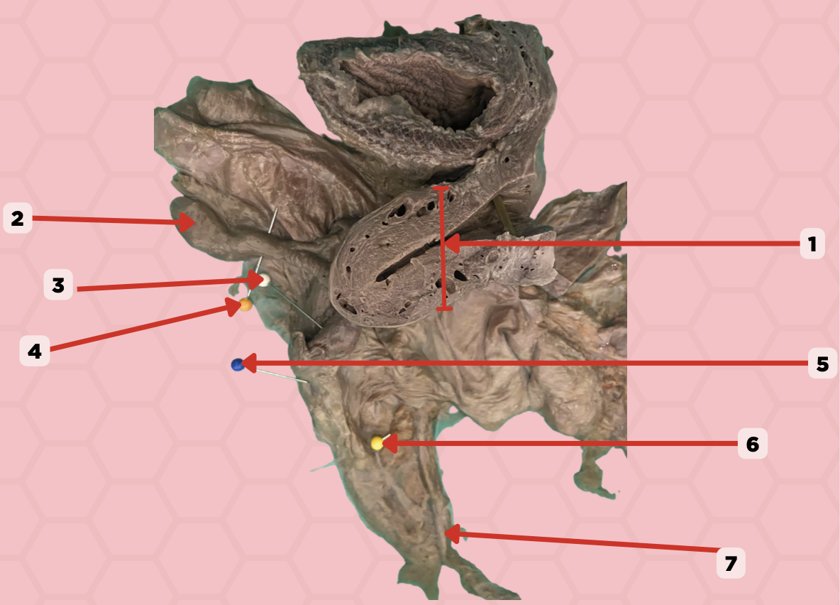 <p>Identify the structure labeled as 6.</p>