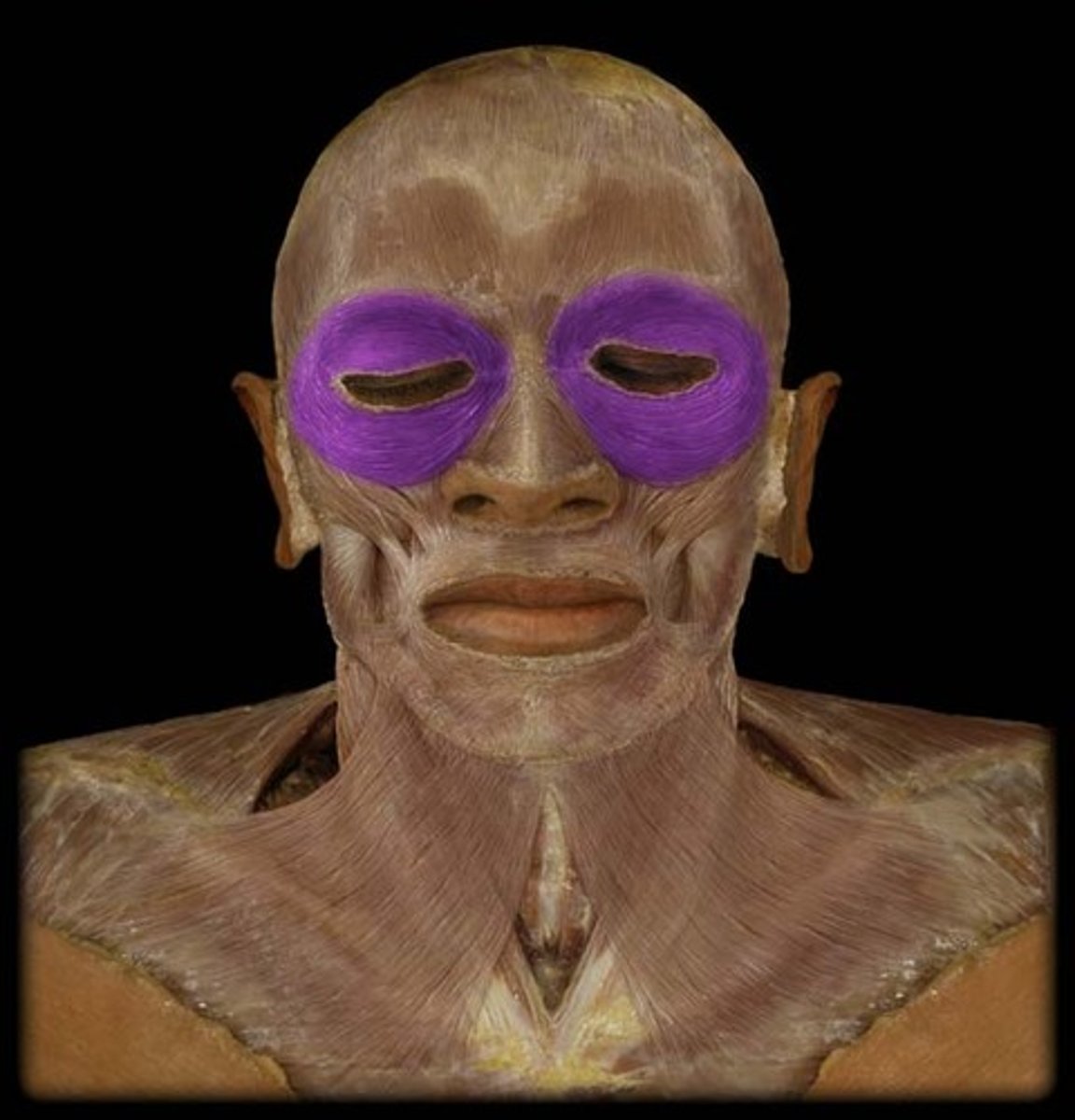 <p>muscles around the eye</p>