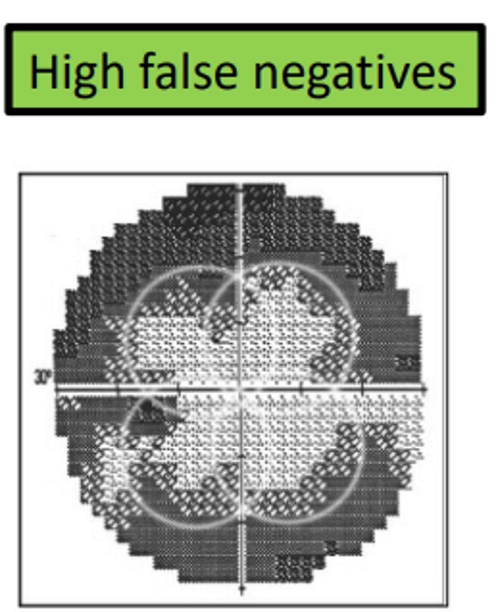 <p>If a patient is fatigued, this will commonly produce a visual field defect in the shape of a _____. This is because the center of the quadrants are tested first.</p>